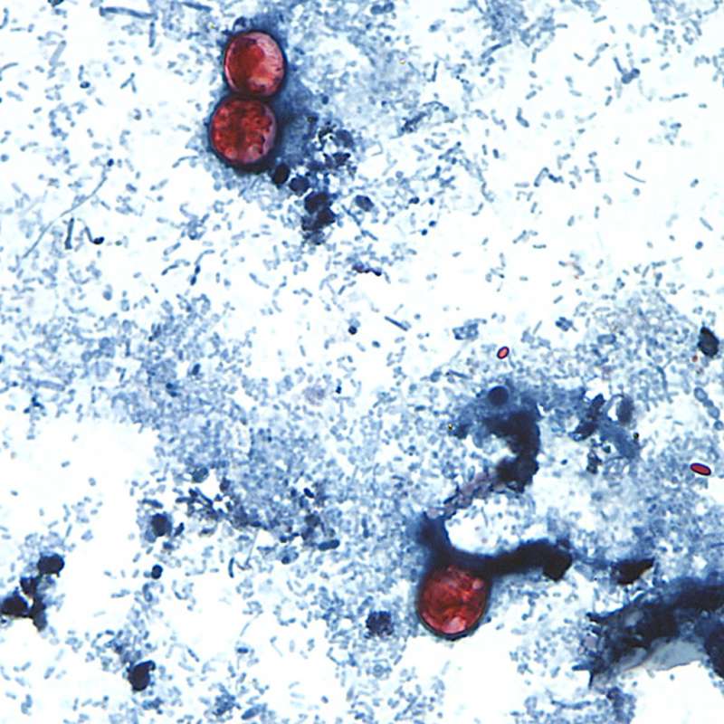 Stomach bug causing ‘explosive’ diarrhea reported in Pa. What you need to know